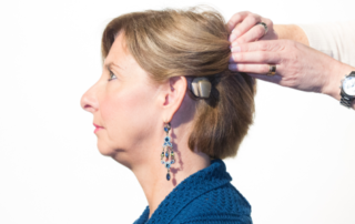 Femme-avec-appareil-auditif-a-conduction-osseuse